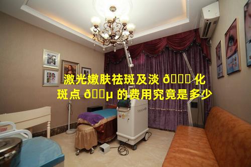 激光嫩肤祛斑及淡 🐋 化斑点 🐵 的费用究竟是多少